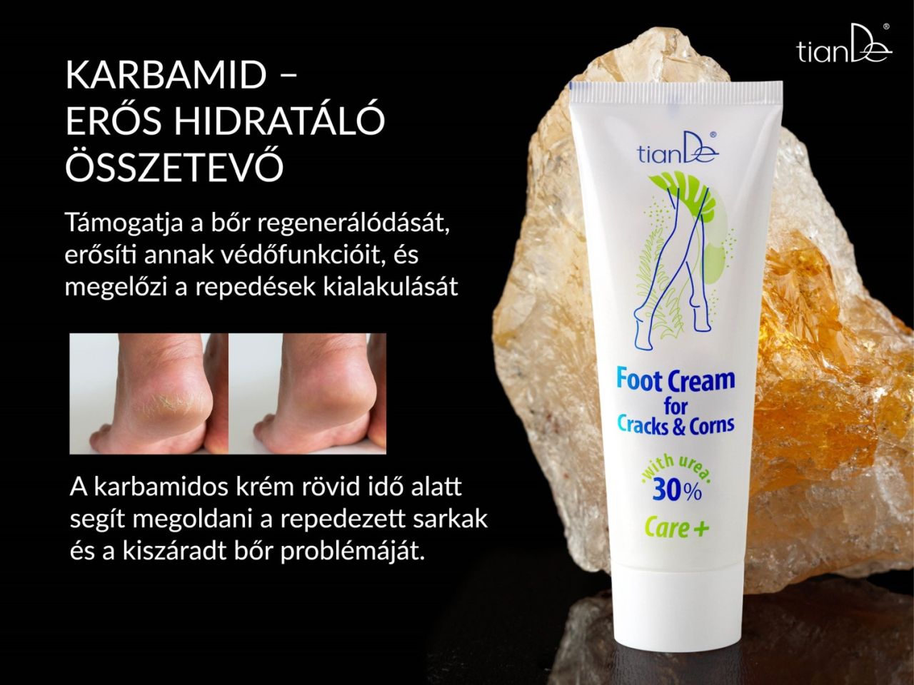 46903- 2-tiande-labkrem-30%-karbamiddal-repedezett-es-borkemenyedeses-borre-03