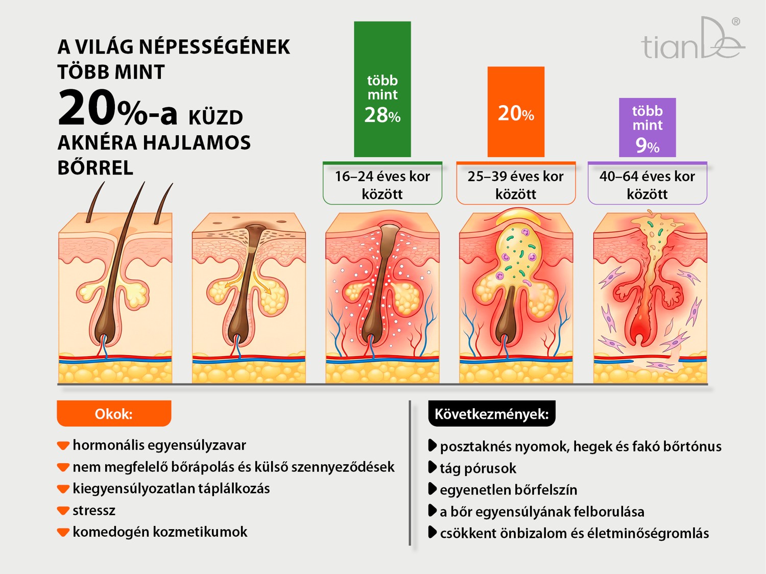 tiande-vita-derm-aknera-hajlamos-arcborapolo-termekcsalad-02