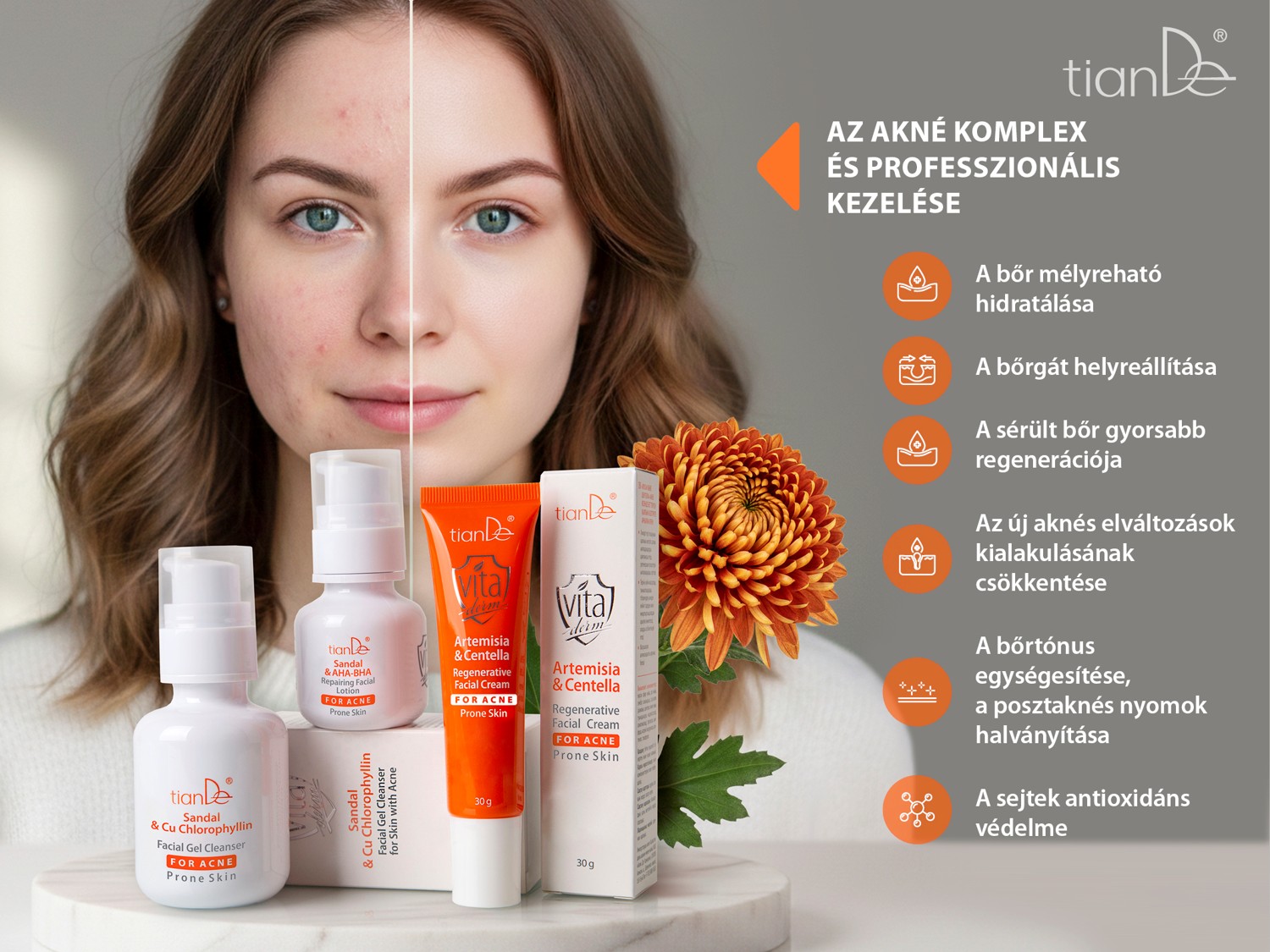 tiande-vita-derm-aknera-hajlamos-arcborapolo-termekcsalad-04